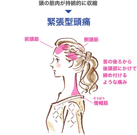 頭痛 解決方法|片頭痛・緊張型頭痛をすぐ治すには？痛みを和らげる。